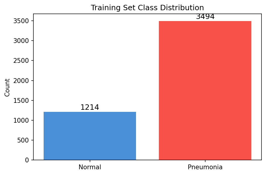 Class distribution