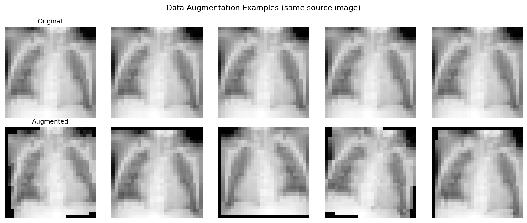 Augmentation examples